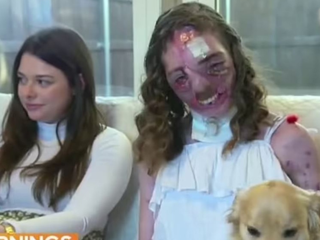 Jacqueline wanted to share her new face to prove she’s ‘not scared’. Picture: CBS News