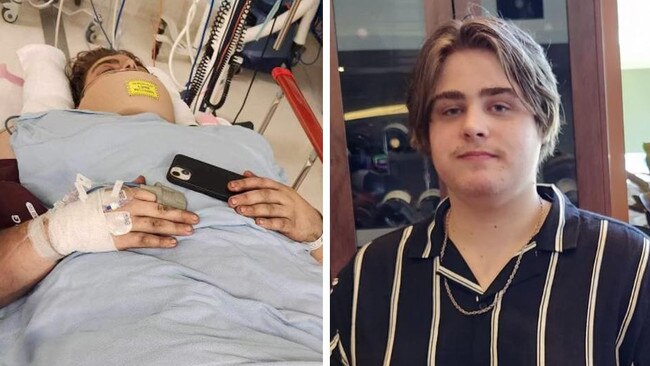‘I see him lying there’: Twin’s despair over teen brother’s life-changing injury