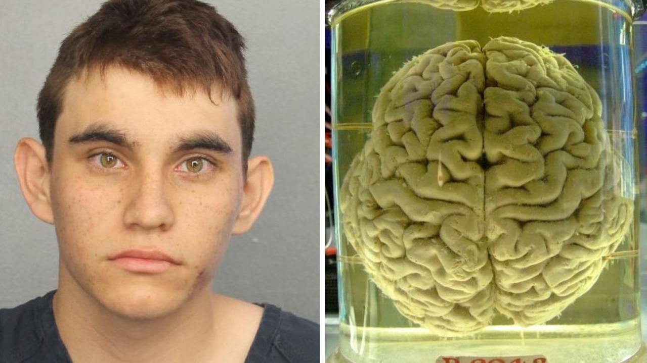 Parkland school shooter Nikolas Cruz donates his brain to science ...