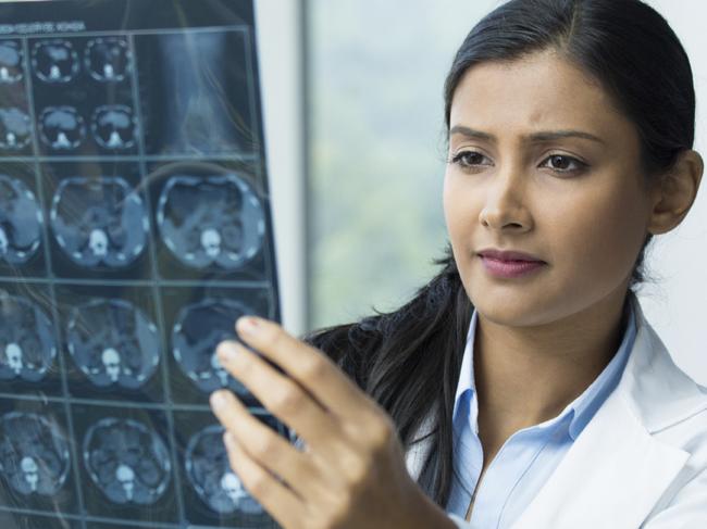 Generic photo in hospital - doctor looking at an xray (x-ray).  Picture: iStock