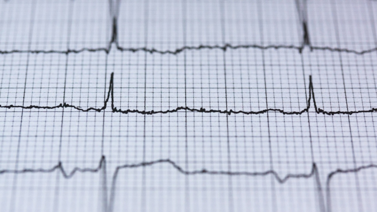 People in Qld and NT have worst heart health in the country: report