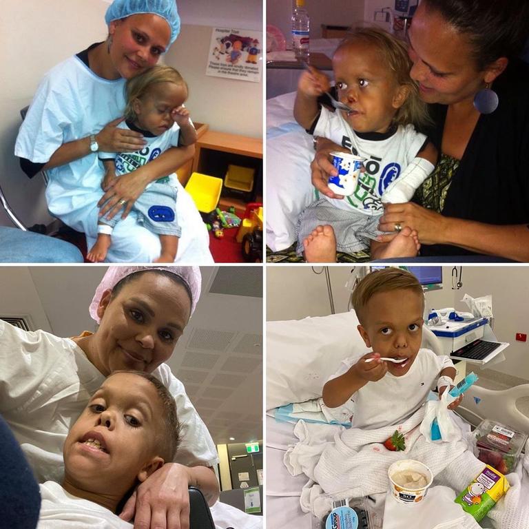 He underwent the same surgery in 2013 as a three-year-old. Picture: Facebook