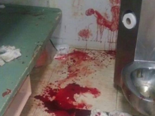 Rymer shared a photo of his bloody prison cell at Silverwater