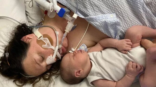 Howrah mum-of-three Hayley Milburn with baby daughter Eden, who was born nine days before she suffered a stroke and brain aneurysm. Picture: GoFundMe