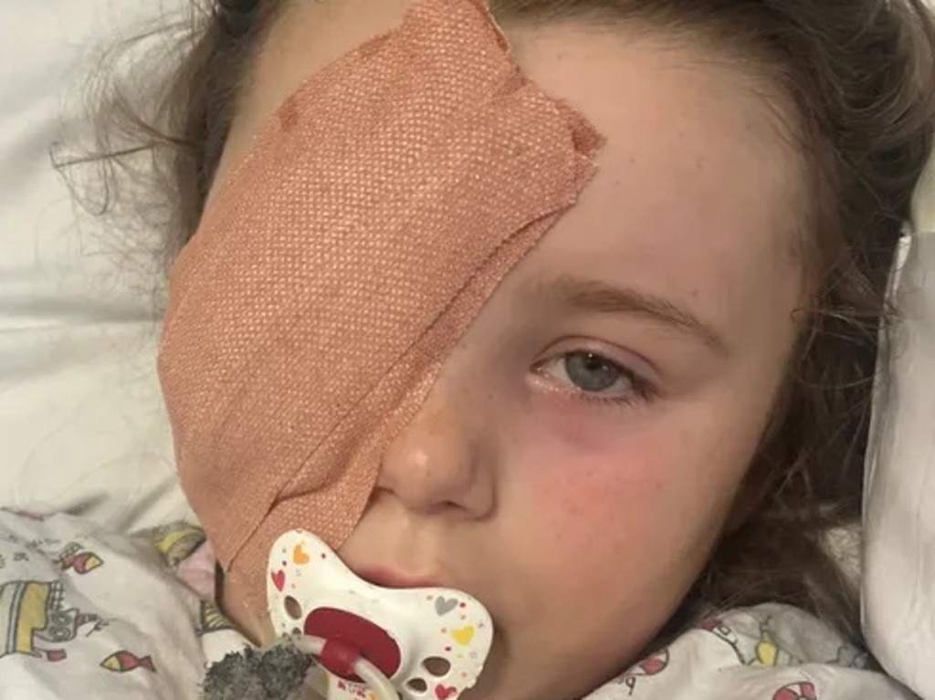 Ruby has lost her eye. Picture: Gofundme.com