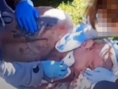 Preston is treated by paramedics after he was stabbed at Barwon Prison. Picture: YouTube