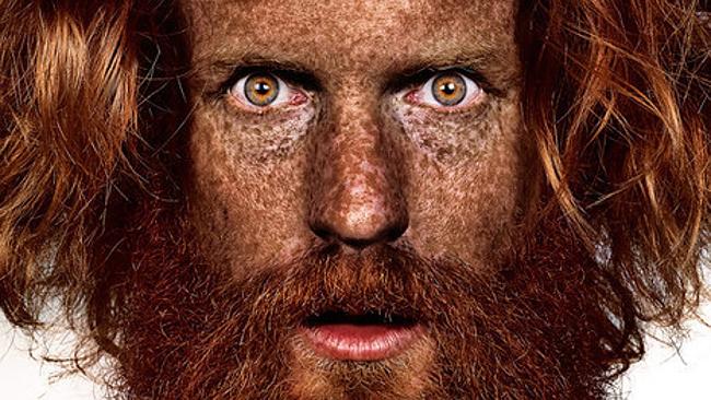 Freckles are so hot right now