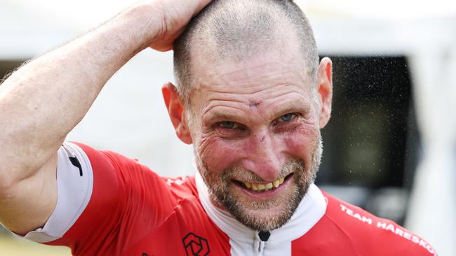 He won despite competing with three stiches in his forehead from a crash in practice earlier in the week. Picture: Brendan Radke