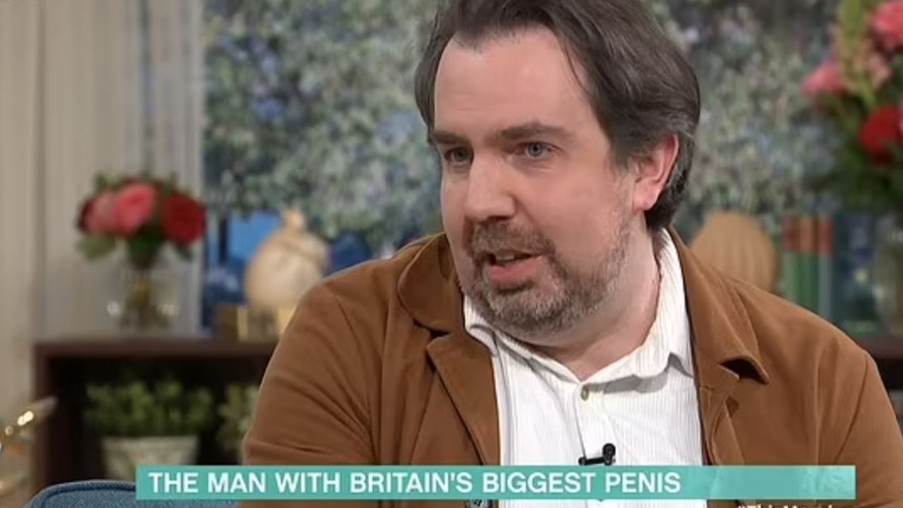 Its Difficult Huge Issue For Man With Countrys Biggest Penis The