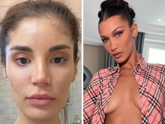 Women are going under the knife to achieve Bella Hadid's facial structure. Picture: Supplied
