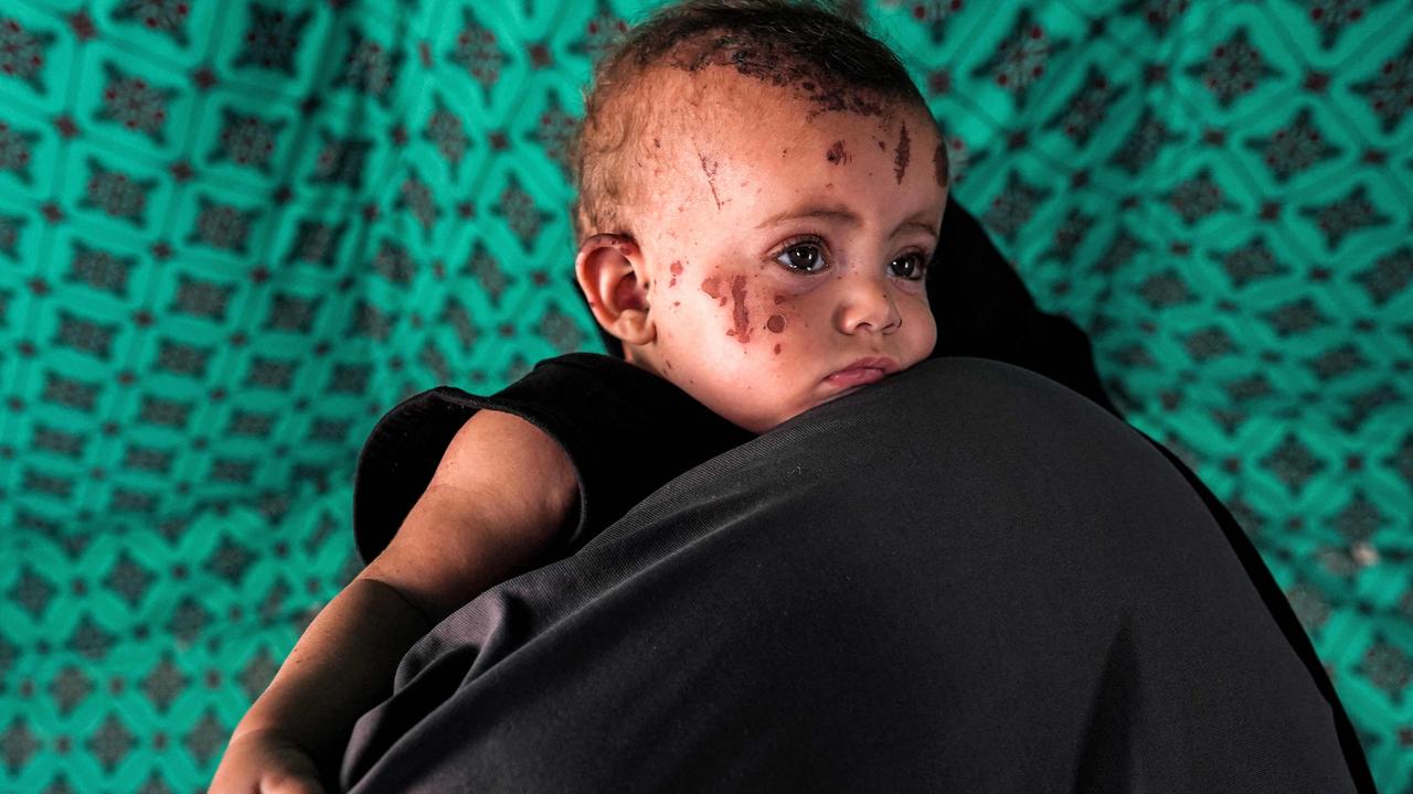 Palestinian toddler Rim Abu Hayya, the sole survivor from her family after they were killed by reported Israeli bombardment that hit their house in the east of Khan Yunis, is carried by her aunt Ayat in a tent shelter west of Khan Yunis in the southern Gaza Strip. Picture: Bashar Taleb/AFP