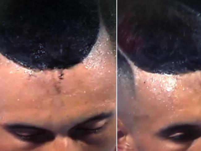 Is that hair dye? Kyrgios’s awkward on court ‘leak’