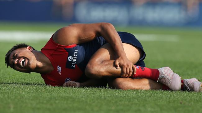 Jay Kennedy-Harris screams in pain after injuring his leg. Picture: Michael Klein