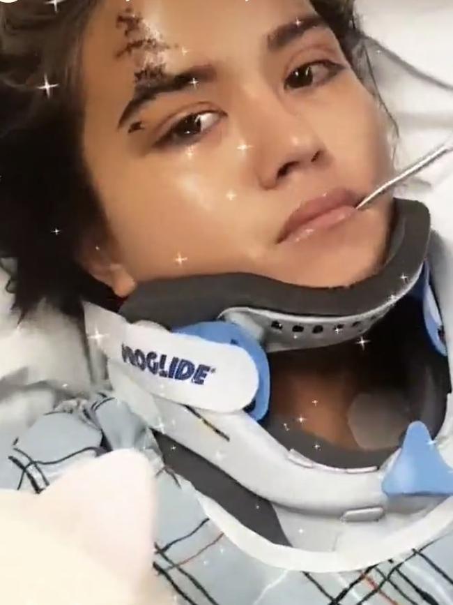 Visaya Hoffie in hospital after the New York subway accident. Picture: Instagram