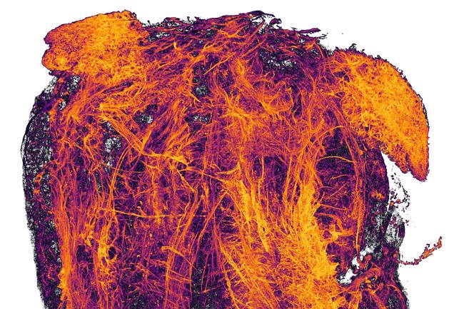 Nikon Small World 2019 20th Place - Blood vessels of a murine (mouse) heart following myocardial infarction (heart attack) Simon Merz, Lea Bornemann &amp; Sebastian Korste University Hospital Essen Institute for Experimental Immunology &amp; Imaging Essen, Nordrhein-Westfalen, Germany