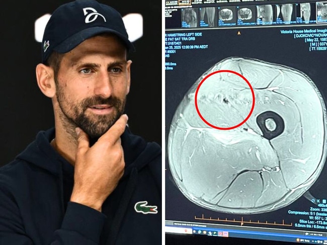 Novak Djokovic shared an MRI of his injured hamstring. Image: Getty/X