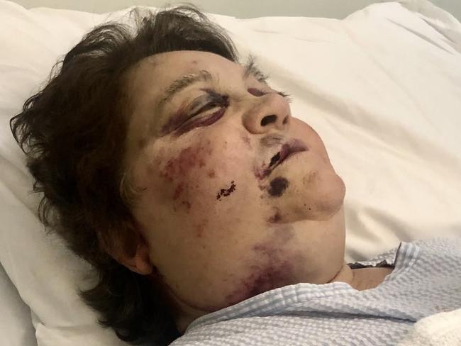 An elderly woman was left bloodied and bruised after a savage attack outside a church in South Yarra, Penelope Katsavos was left bloodied and bruised after the horrific attack.