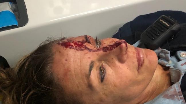 A man allegedly assaulted a police officer on the Central Coast in July. Picture: NSW Police