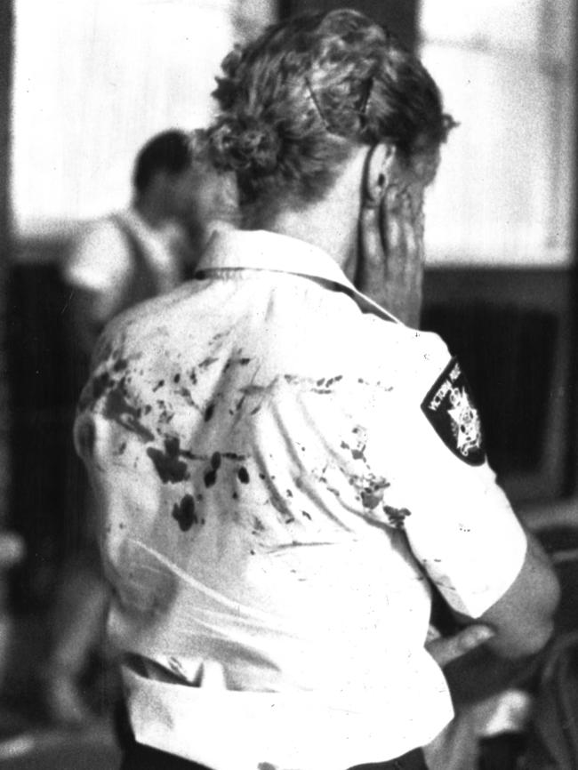 An injured policewoman after the blast.