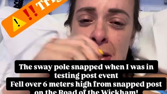 Leonie Ceraolo revealed she shattered her jaw in the accident. Picture: Instagram