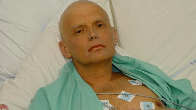 Alexander Litvinenko asked for this photo to be taken of him in hospital, saying: ‘I want the world to see what they did to me.’ He died three weeks after the attack.