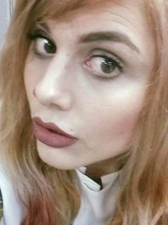 Evie Amati is accused of the axe attack. Picture: Facebook