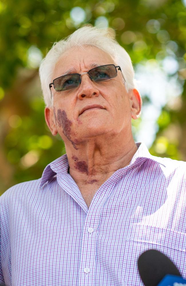 Darwin mayor Kon Vatskalis has urged the government to forcibly buy back some grocery store liquor licences if not enough are voluntarily sold. Photograph: Che Chorley