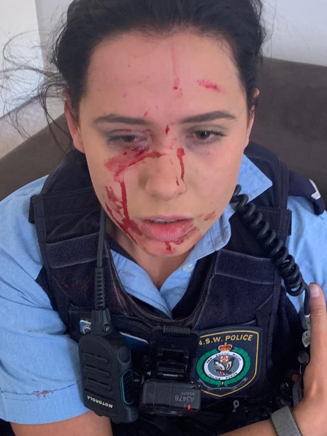 An officer who was allegedly assaulted at Brighton Le Sands.