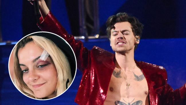 Harry Styles falls victim to violent new trend against performers