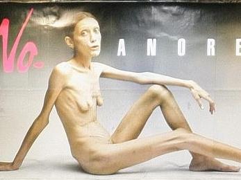 Anorexic advertising to be criminalised