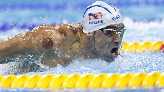 USA's Michael Phelps made headlines yesterday when appeared at the pool with circular bruises on his shoulder. Picture: Odd Andersen/AFP