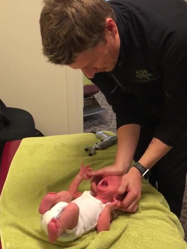 Chiropractor Dr Andrew Arnold uses the palms of his hands to push on the baby’s skull, describing the action as being like “pushing on a balloon”.