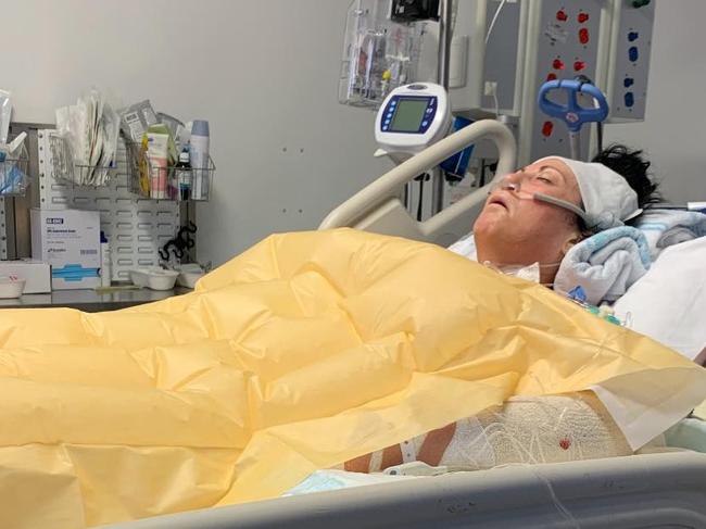 Lynda Watson, 51, an aged care support worker who was mauled by a dog at Condell Park last week. Pic of her in ICU where she is expected to be for many weeks. Pic supplied by family,