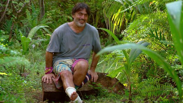 Ross Clarke-Jones suffered an ankle injury on the set of Survivor. Picture: Network 10