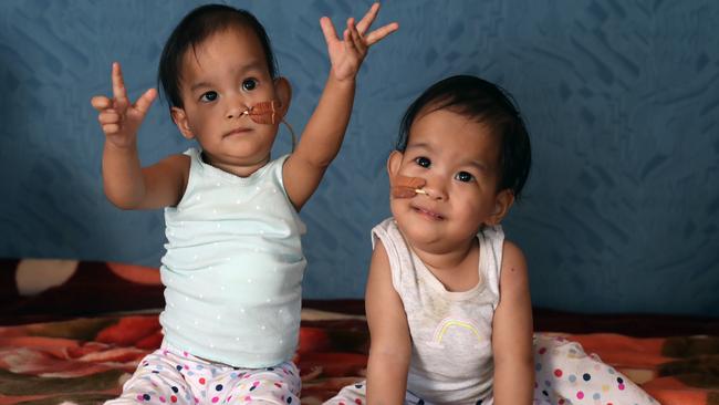 The Bhutanese twins Dawa (left) and Nima (right) are making huge progress after leaving hospital. Picture: Alex Coppel