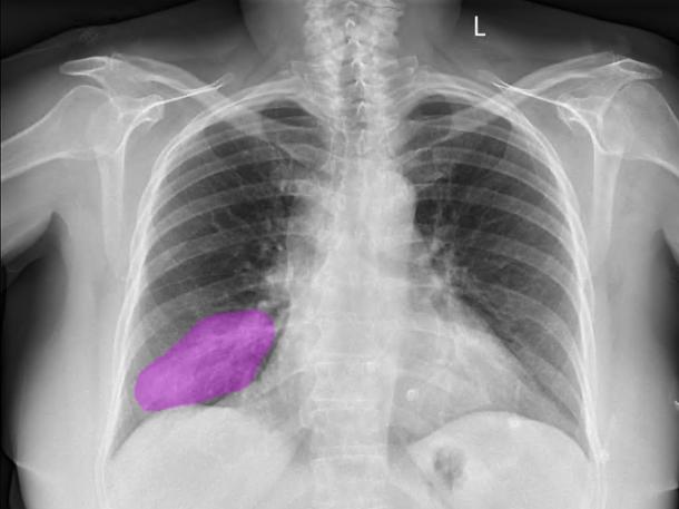 SAMI story - AI supporting the future of medical imaging in SA Chest x-rays taken using the help of AI at SA Medical Imaging. Picture: Supplied