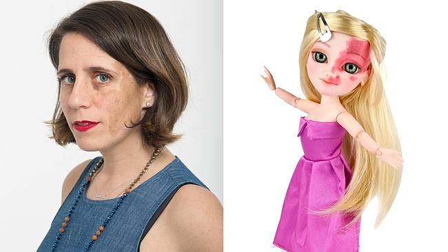 Kirsten Fleming isn’t a fan of the UK’s latest import: dolls with birthmarks.