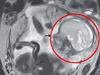 Utterly wild discovery in woman’s X-ray