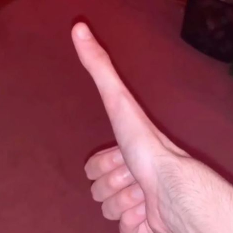 Womans Giant Five Inch Middle Finger Goes Viral On Tiktok The Advertiser 