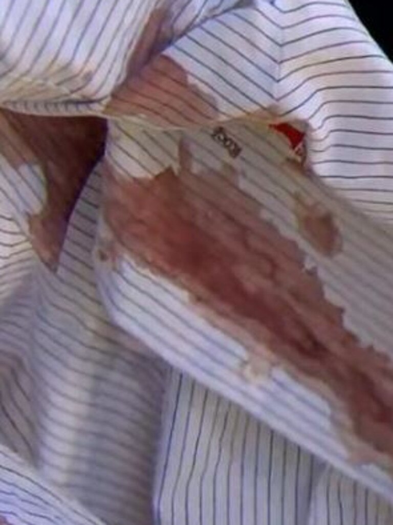 His uniform was soaked in blood. Picture: 9News