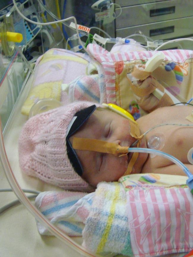 Baby Ella only survived for 23 hours after she was born with CMV.