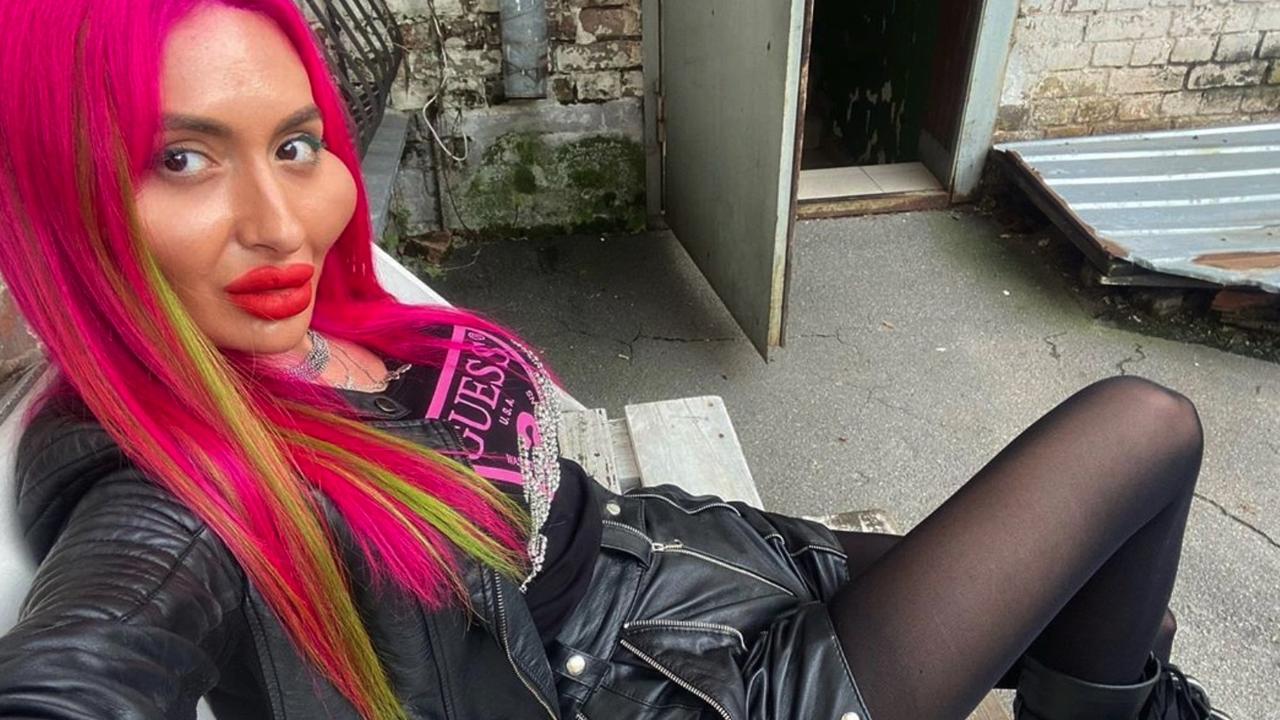 She says she has lost count of how many procedures she has had. Picture: Instagram