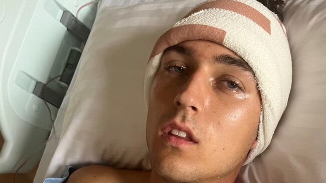 Zac Dumesny in hospital recovering after brain surgery. Picture: Supplied/Nicole Dumesny