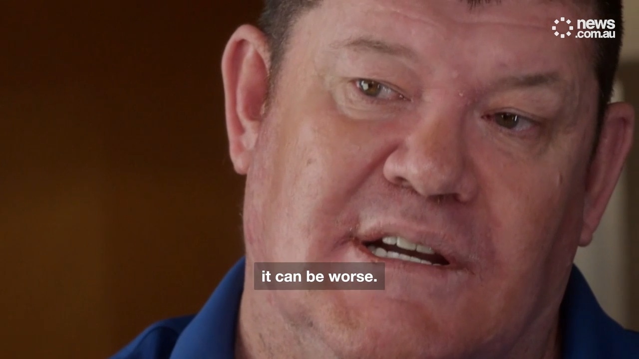 James Packer opens up on mental health struggles