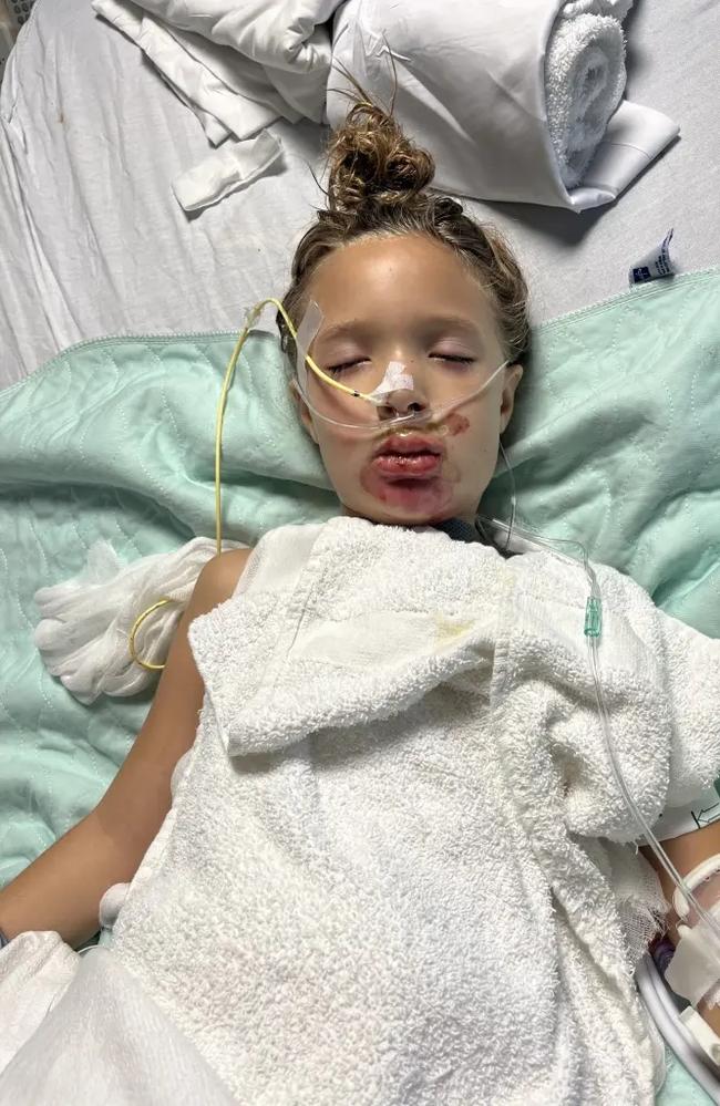 7-year-old Scarlett Selby was left in a coma after a squishy toy exploded while she was attempting a viral TikTok challenge. Picture: Supplied