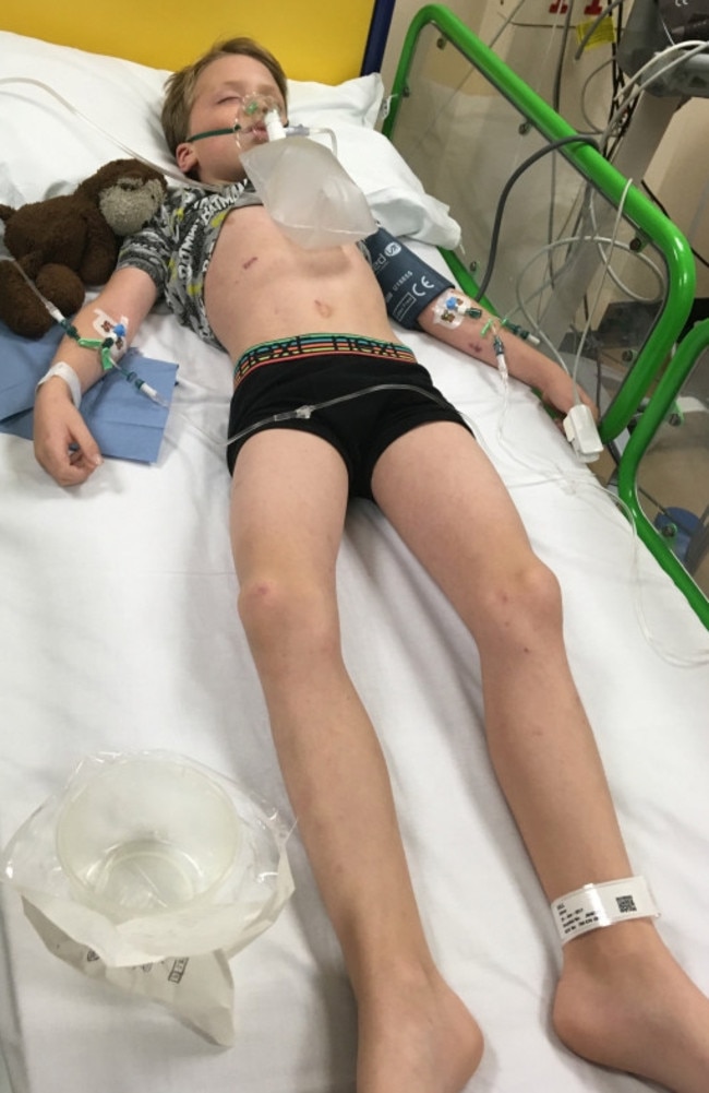 Paramedics ‘rolled their eyes’ and told Ollie’s mum her son was ‘milking it’. Picture: SWNS/Mega