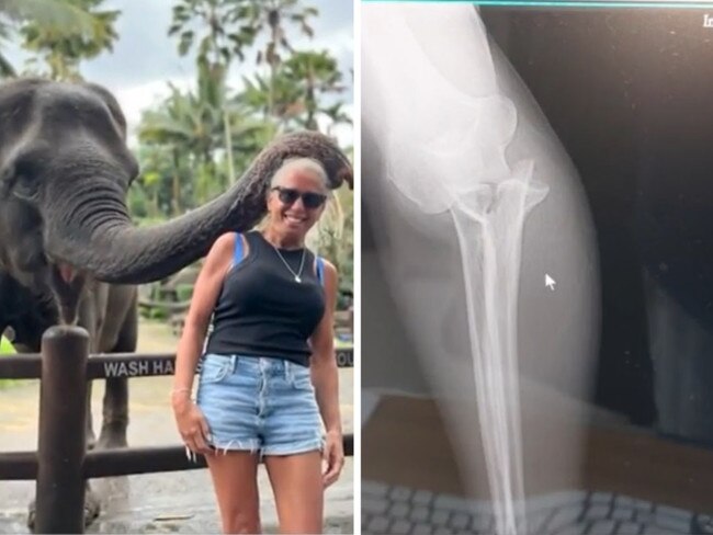 Bali tourist’s arm crushed by elephant