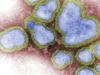 Girl, 4, one of Qld’s horror flu death toll