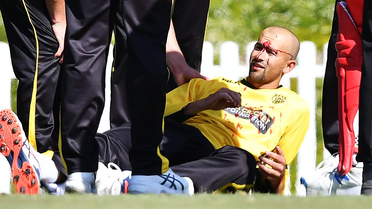 Ashton Agar of the Warriors was hit in the head while fielding a ball during the Marsh One Day Cup match between South Australia and Western Australia at Karen Rolton Oval. (Picture: Mark Brake