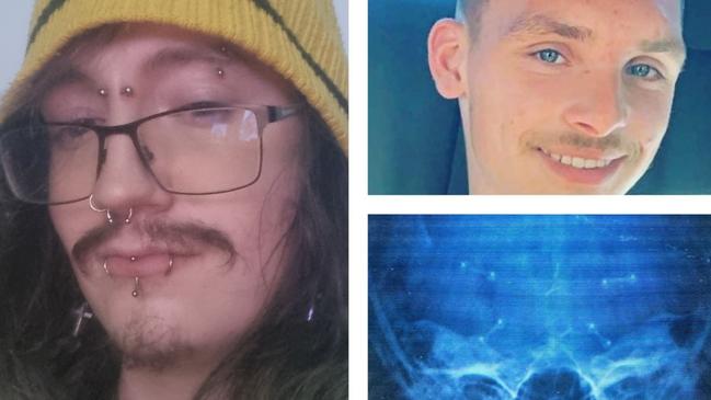 Rhys Diedrichs (left) suffered a horrendous, unprovoked attack by Logan teen Billie Jai Thorp (right) which almost killed him in April, 2022